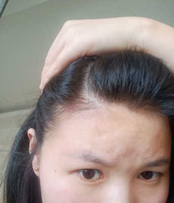 小菲洗发水效果怎么样好用吗，使用一个月后评价(修发/护发)